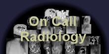 On Call Radiology - Emergency Room and on call Radiology cases and teaching files