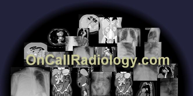 Emergency Radiology lecture and on call Radiology cases and teaching files